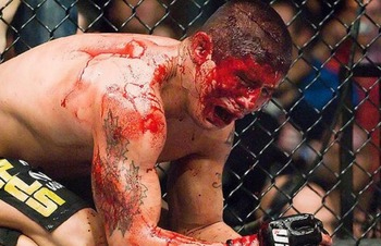 Red vs Blue UFC Team Red